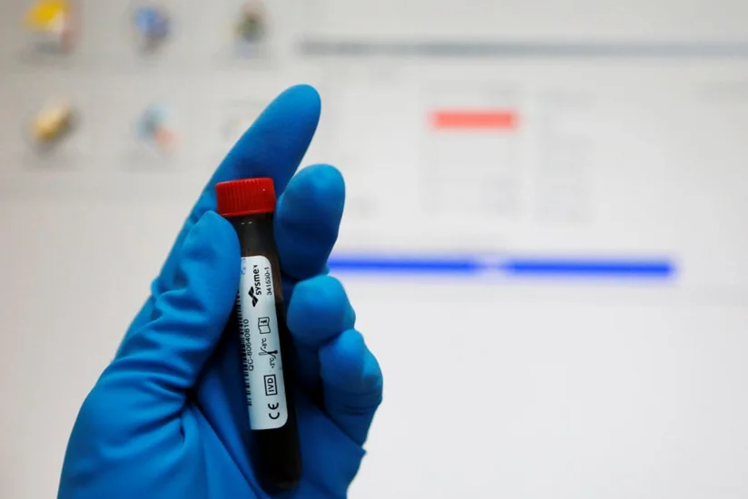 2015-ci ildə antidopinq qaydalarını pozmuş Azərbaycan idmançılarının adları müəyyənləşib