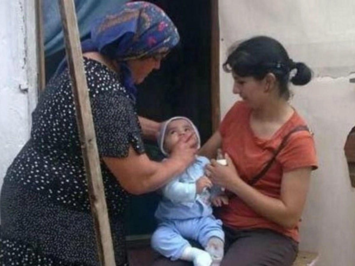 Отводить ли ребенка к чопчу?