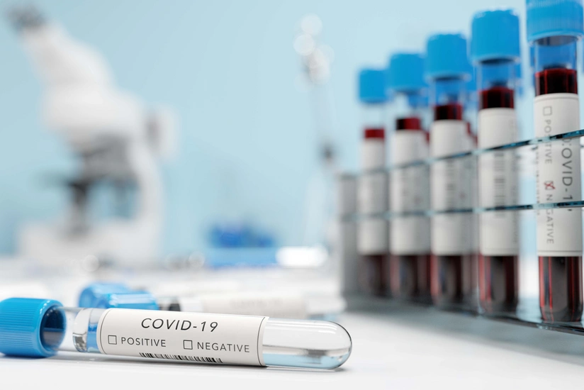 Koronavirusa qarşı immunitet 1 ay sonra təsirini itirir