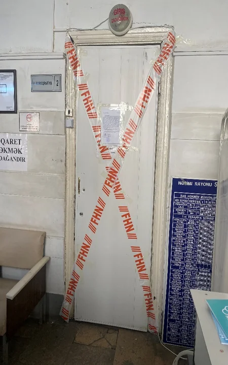 Bir sıra tibb müəssisələrinin rentgen müayinə fəaliyyəti dayandırılıb