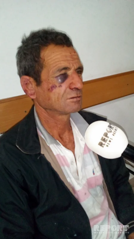 Şamaxıda kütləvi dava: Ər-arvad döyülüb - FOTO
