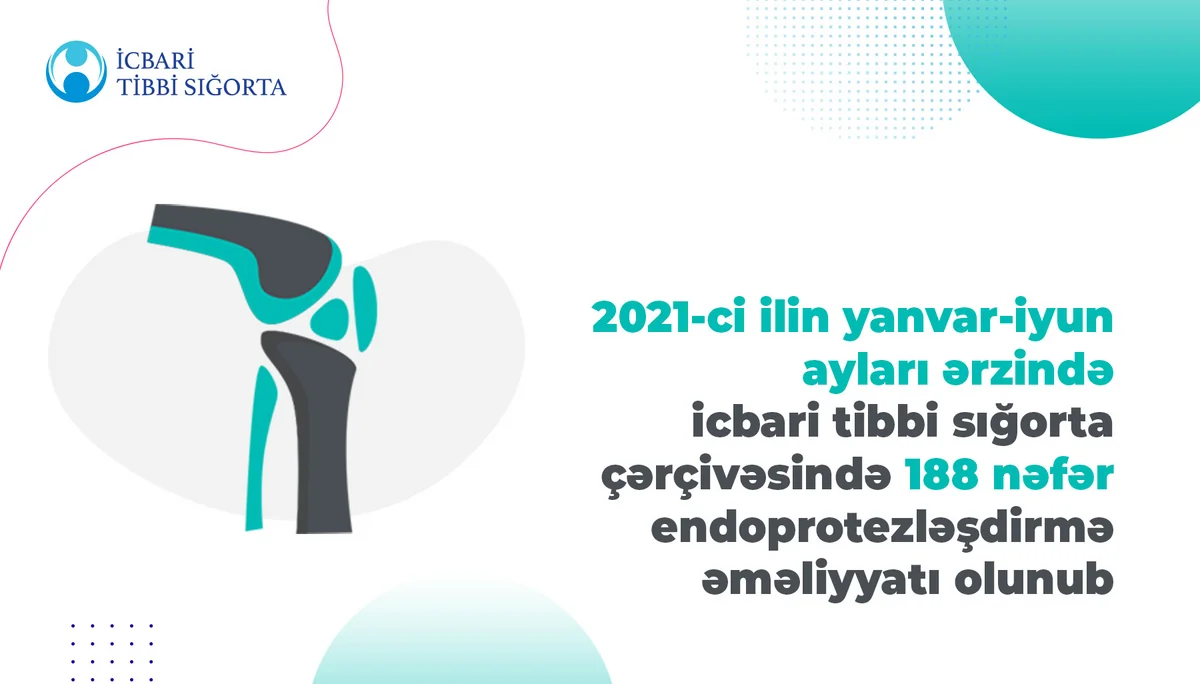 Bu il 188 nəfər endoprotezləşdirmə əməliyyatı olunub