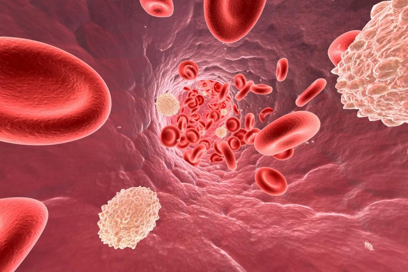 Sign of dangerous cholesterol levels revealed