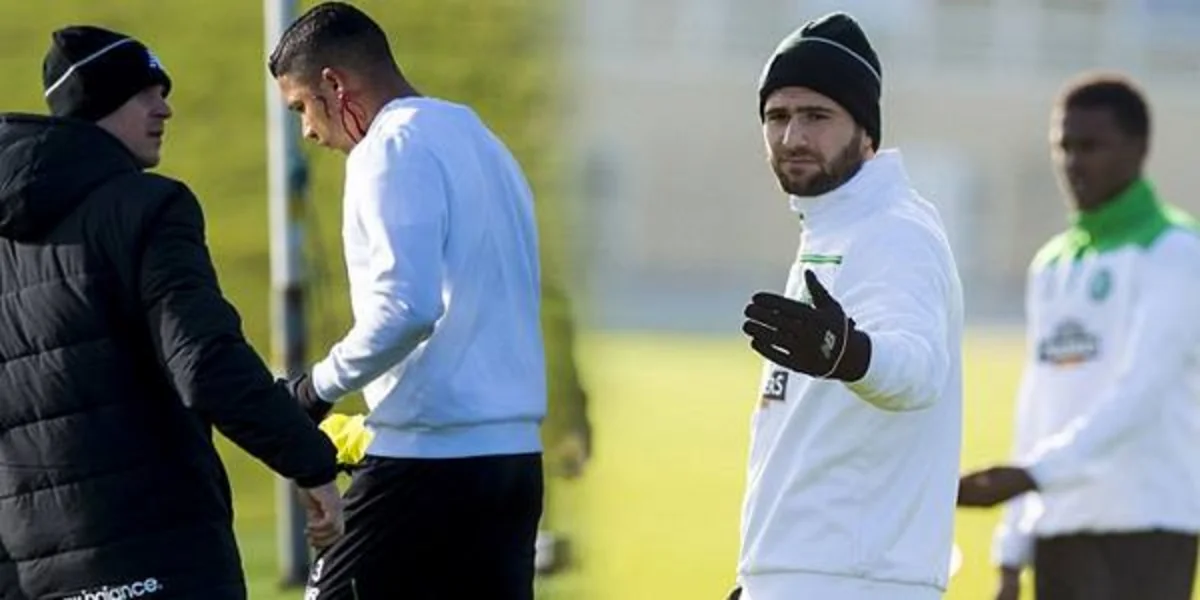 Seltik futbolçuları arasında qanlı dava düşüb