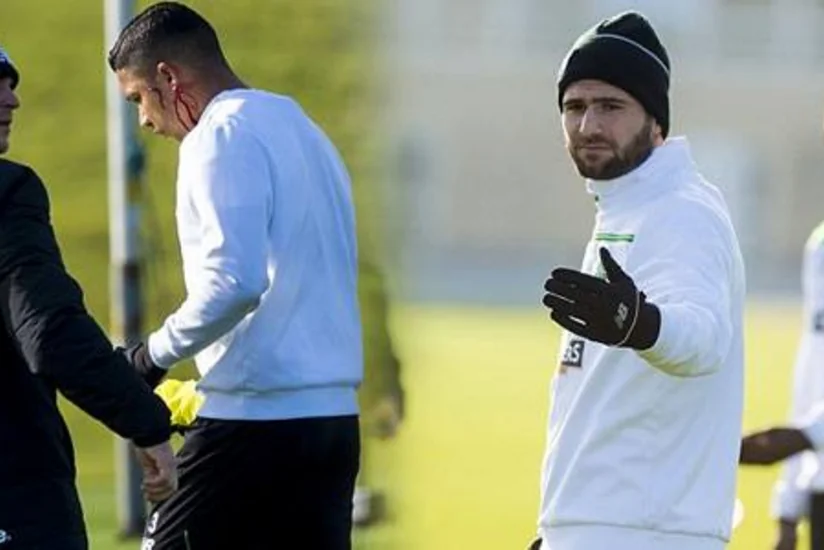 Seltik futbolçuları arasında qanlı dava düşüb