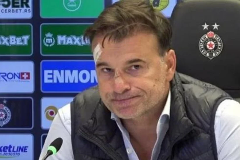 Azarkeşlər Serbiya klubunun baş məşqçisinə xəsarət yetiriblər