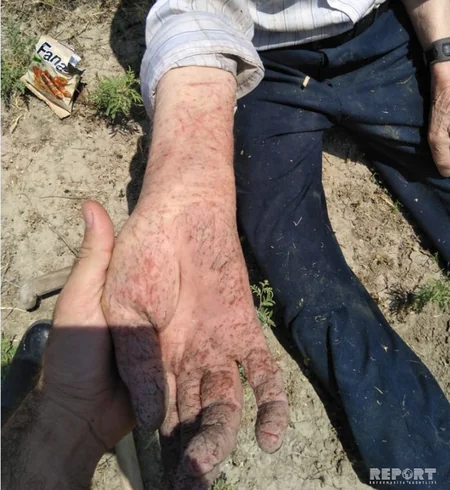 В Барде 80-летний мужчина провел более суток в водоканале - ФОТО