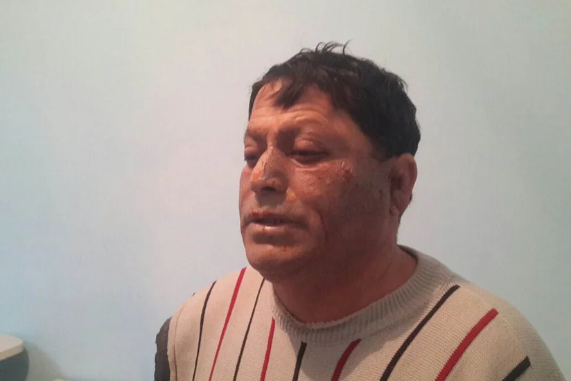 В хлебном цехе на Абшероне прогремел сильный взрыв, 3 человека тяжело ранены - ФОТО