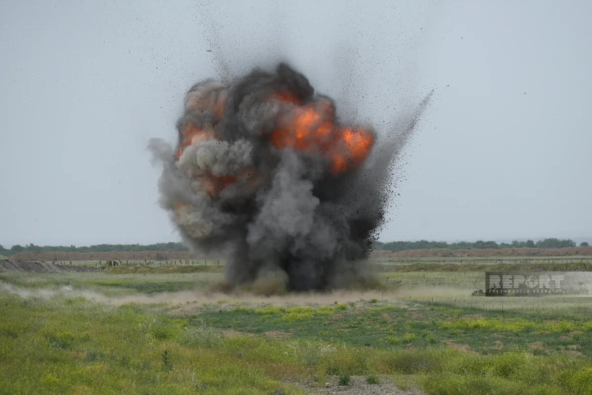 Подорвавшемуся на мине в Агдере ампутируют ногу