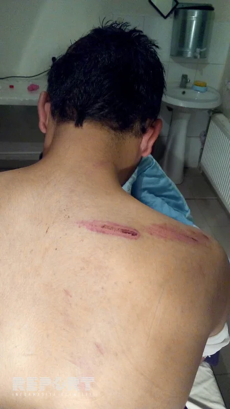 Şamaxıda 17 yaşlı gənc qayadan yıxılıb - FOTO