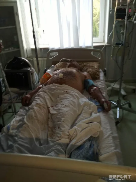 Tərtərdə əl qumbarası partlayıb, ölən və yaralanan var - FOTO - VİDEO - YENİLƏNİB