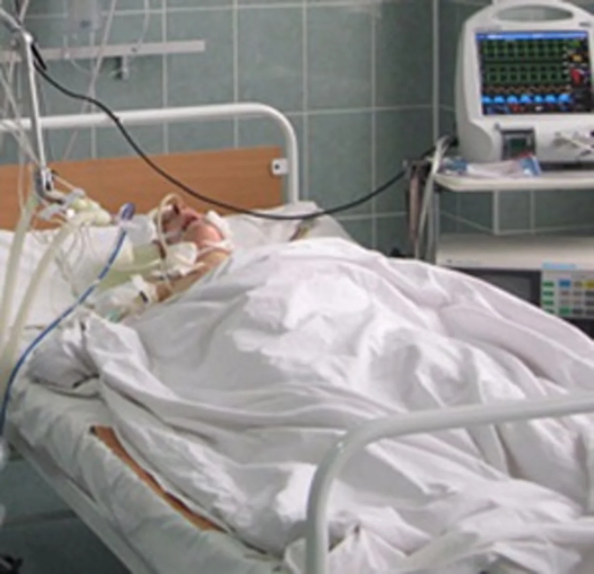 Bakıda 79 yaşlı kişi yanaraq ölüb