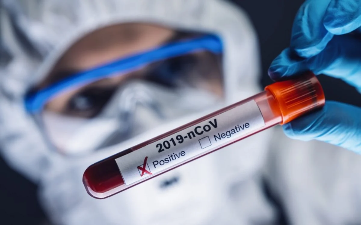 “Koronavirus təhlükəsi hələ sovuşmayıb, arxayın olmamalıyıq” - RƏY
