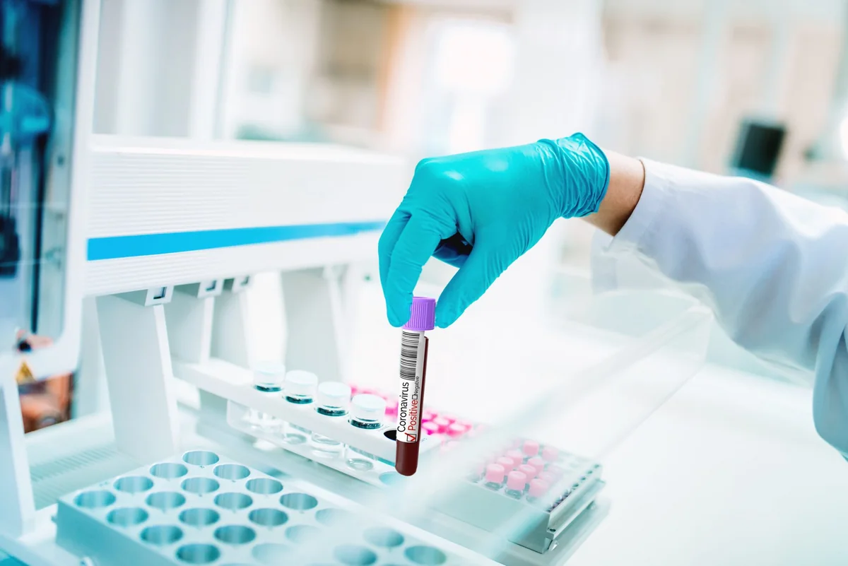 Azerbaijan reports 1,346 new coronavirus cases: Task Force