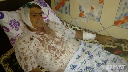 İmişlidə heyvan bazarında kütləvi dava düşüb, ata və 3 oğlu döyülüb - FOTO