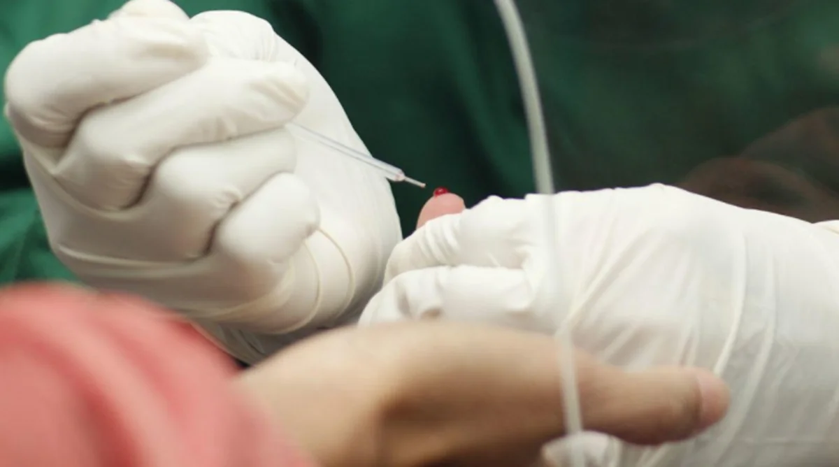 У каждого третьего пациента с COVID-19 находят сепсис