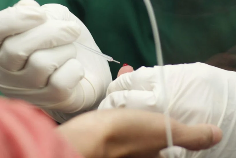 У каждого третьего пациента с COVID-19 находят сепсис