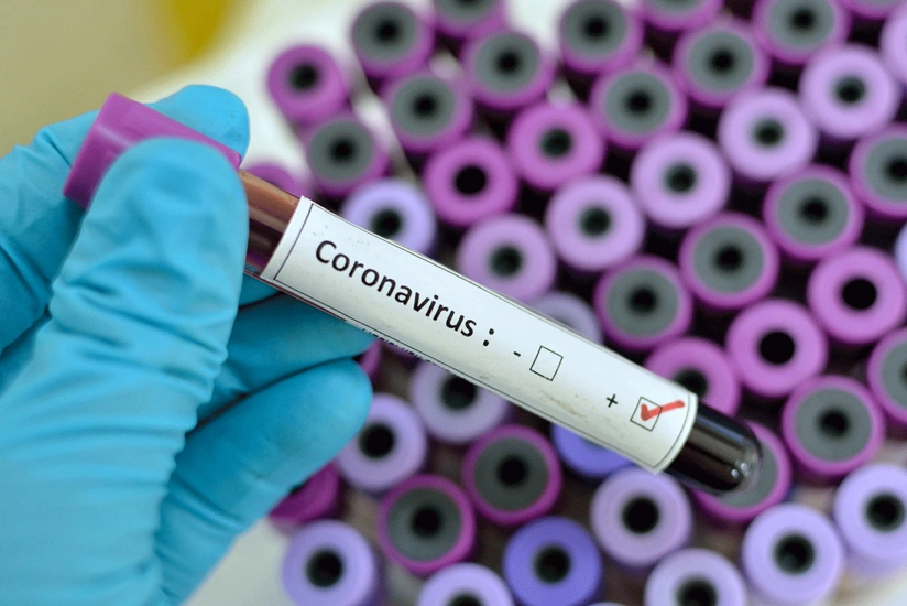 New COVID-19 variant Pirola 'more infectious,' but not 'more severe', says expert
