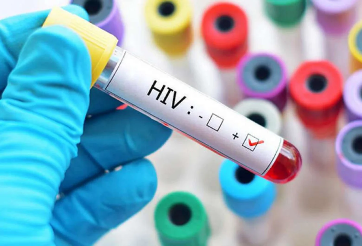 Третий человек в мире излечился от ВИЧ