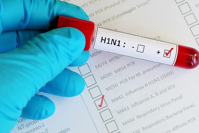 Gürcüstanda iki nəfərin “donuz qripi”ndən ölməsi təsdiqlənib