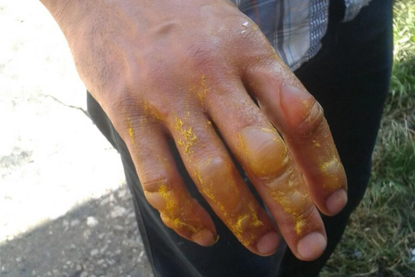 Qubada təbii qaz balonunun partlaması nəticəsində ev yanıb, bir nəfər xəsarət alıb - FOTO - VİDEO