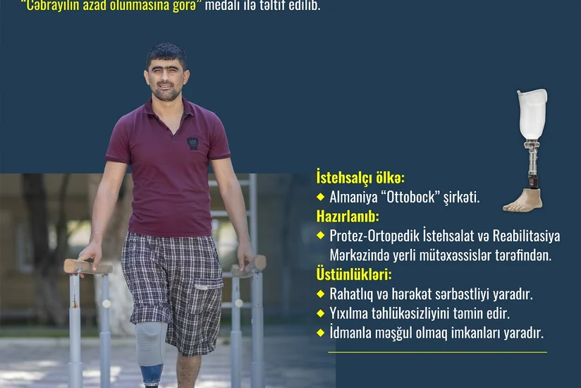 66 qazimiz yüksək texnologiyalı protezlərlə təmin edilib
