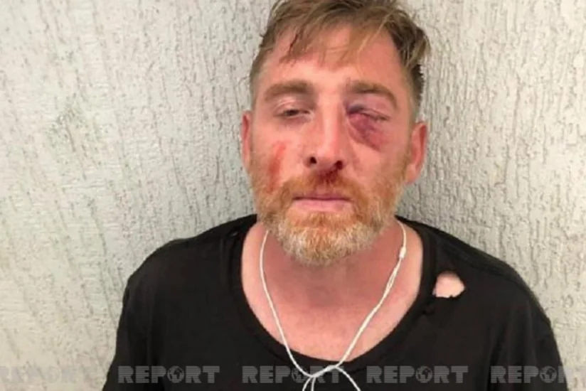 Gürcüstanda vəfat edən operatorun ilkin ölüm səbəbi açıqlanıb