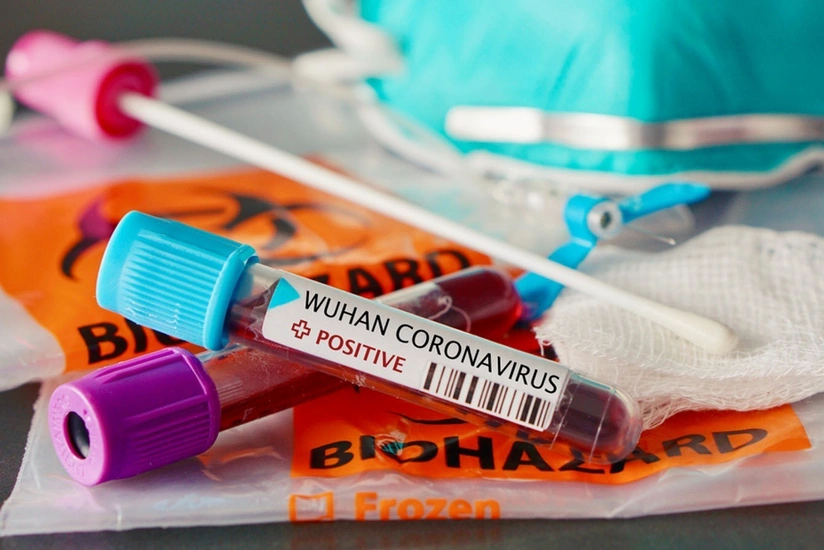 ÜST: Koronavirus əleyhinə mübarizədə problem yaranıb