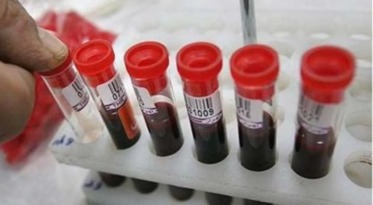 Nikaha daxil olmaq istəyənlər arasında talassemiya daşıyıcıları üzrə vahid elektron proqramı hazırlanacaq