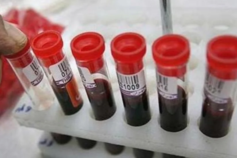 Nikaha daxil olmaq istəyənlər arasında talassemiya daşıyıcıları üzrə vahid elektron proqramı hazırlanacaq