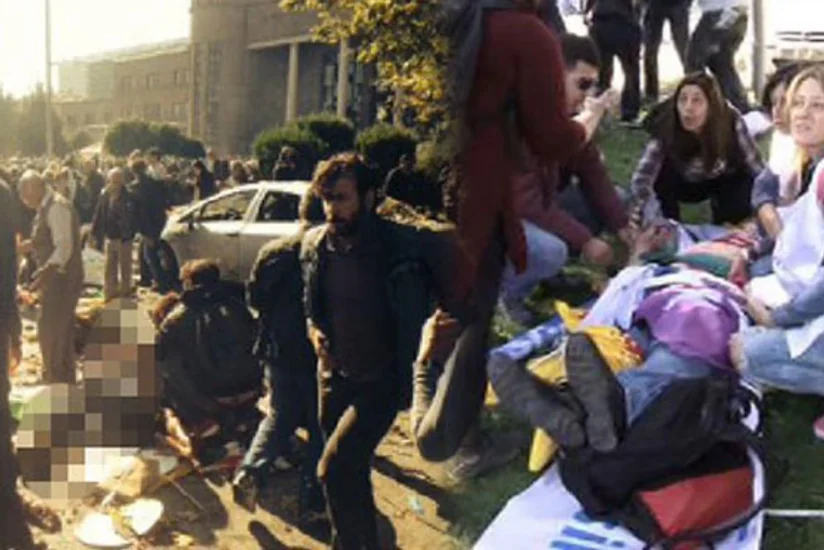 ​Türkiyənin səhiyyə naziri: Ankarada törədilən terrorda ölənlərin sayı 86-ya çatıb