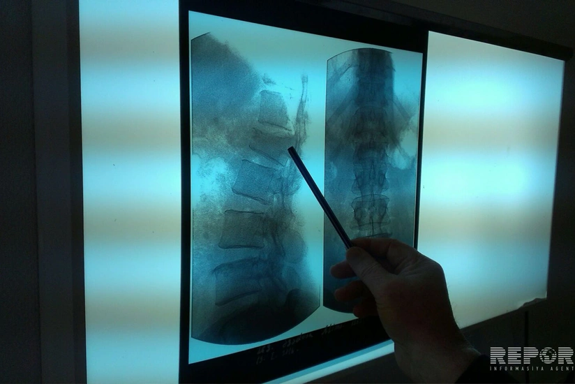 Astarada 57 yaşlı qadın pəncərədən yıxılaraq xəsarət alıb - FOTO