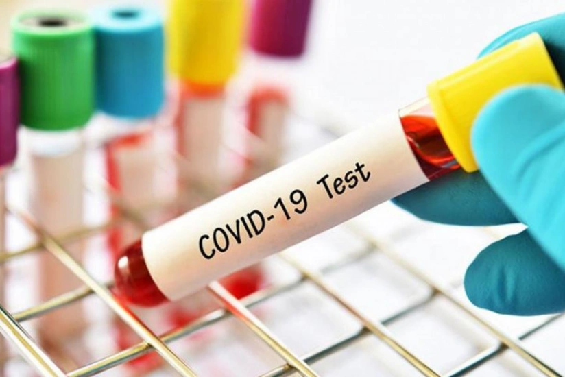 Mütəxəssis koronavirus testlərinin fərqli nəticələr göstərməsinə aydınlıq gətirib