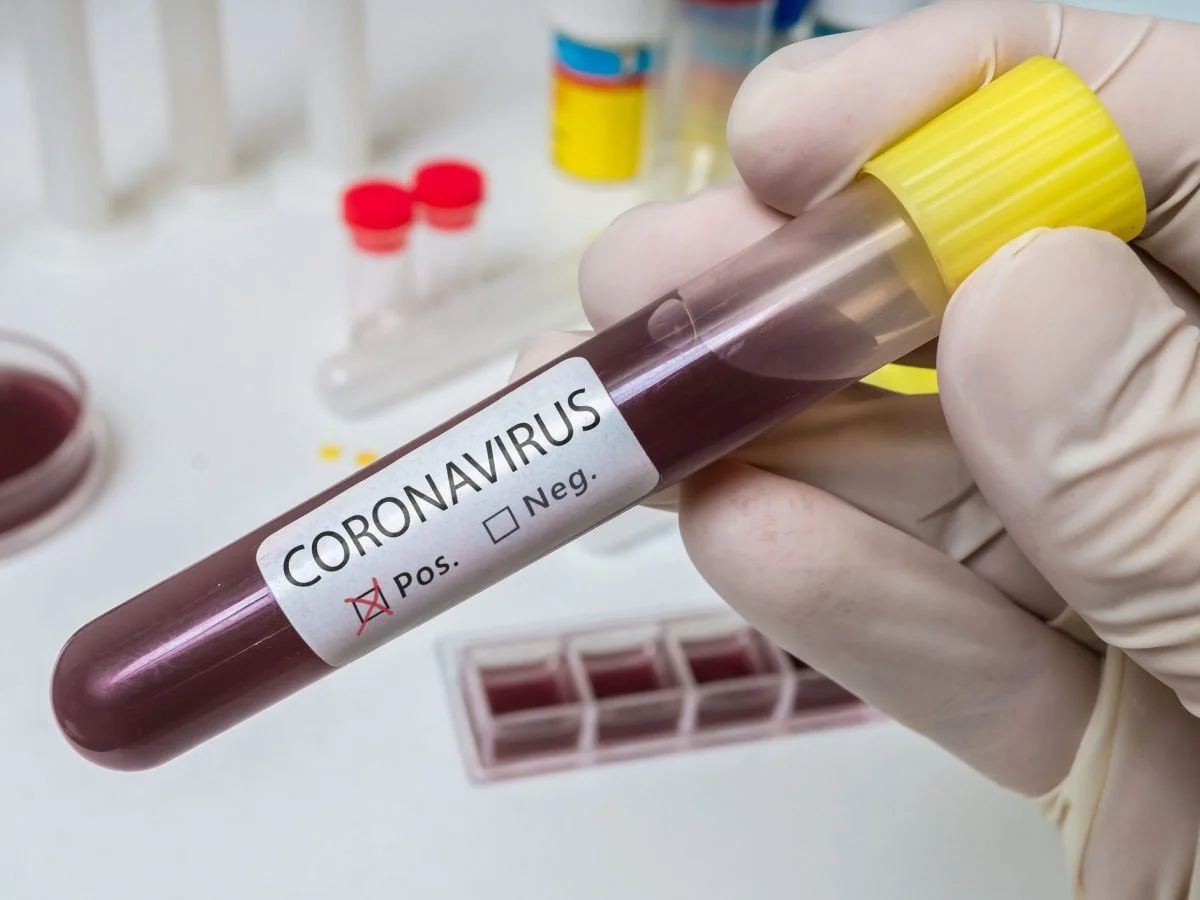 Azerbaijan confirms 75 new coronavirus cases