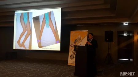 Uşaqlarda daha çox rast gəlinən pediatrik və ortopedik problemlərə müasir yanaşma mövzusunda konfrans keçirilib