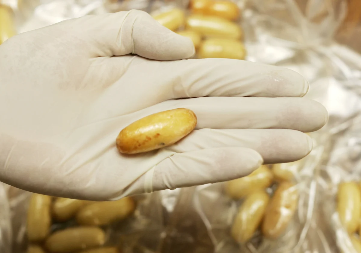 Azərbaycan vətəndaşının daxili orqanında 13 büküm heroin aşkar edilib