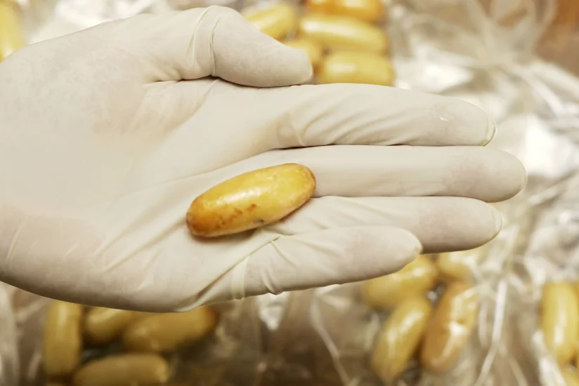 Gömrükçülər Azərbaycan vətəndaşının daxili orqanında narkotik vasitə aşkar edib