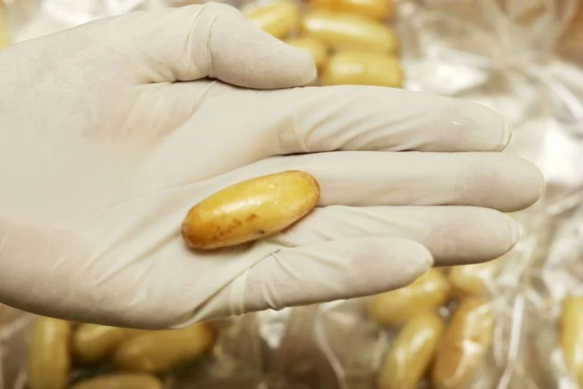 Azərbaycan vətəndaşının daxili orqanında heroin aşkar edilib