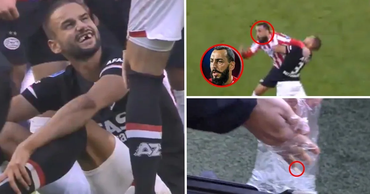Qalatasarayın sabiq futbolçusu yunanıstanlı həmyerlisinin dişlərini qırıb