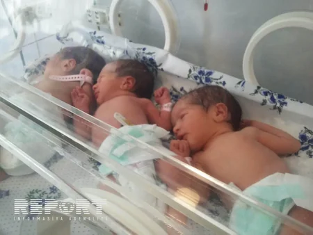 ​Bərdədə 10 ildir övladı olmayan ailənin üçəm qızları dünyaya gəlib - FOTO
