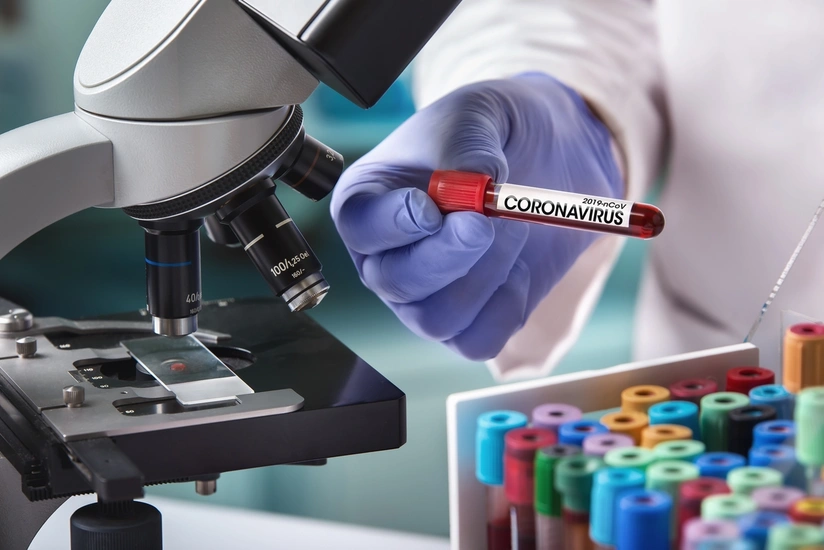Azerbaijan reports 13 new COVID-19 cases