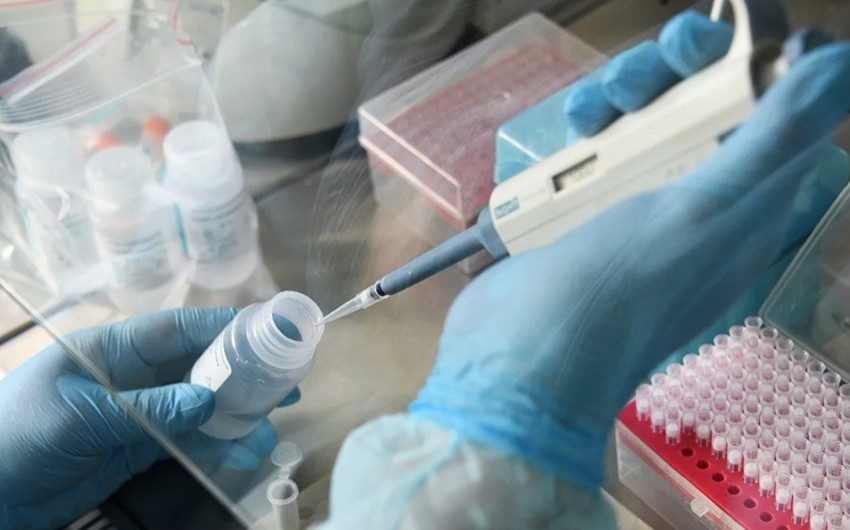 Koronavirusun diaqnostikası üçün testlər Azərbaycana gətirilib - EKSKLÜZİV