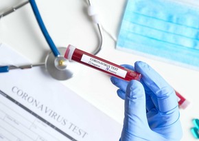 Azərbaycanda 4 273 yeni yoluxma faktı qeydə alınıb, 41 nəfər vəfat edib