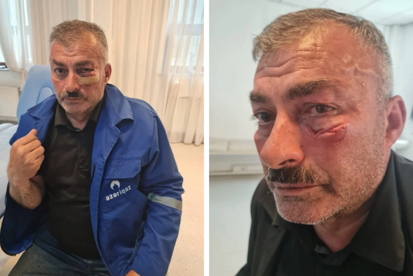 “Azəriqaz”ın əməkdaşına qarşı zor tətbiqi ilə bağlı cinayət işi başlanıb