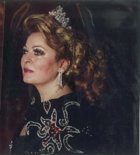 Türkiyənin tanınmış opera müğənnisi vəfat edib
