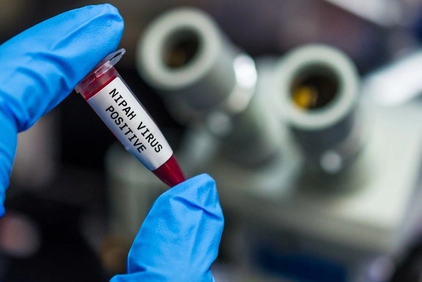 Outbreak of deadly Nipah virus recorded in India