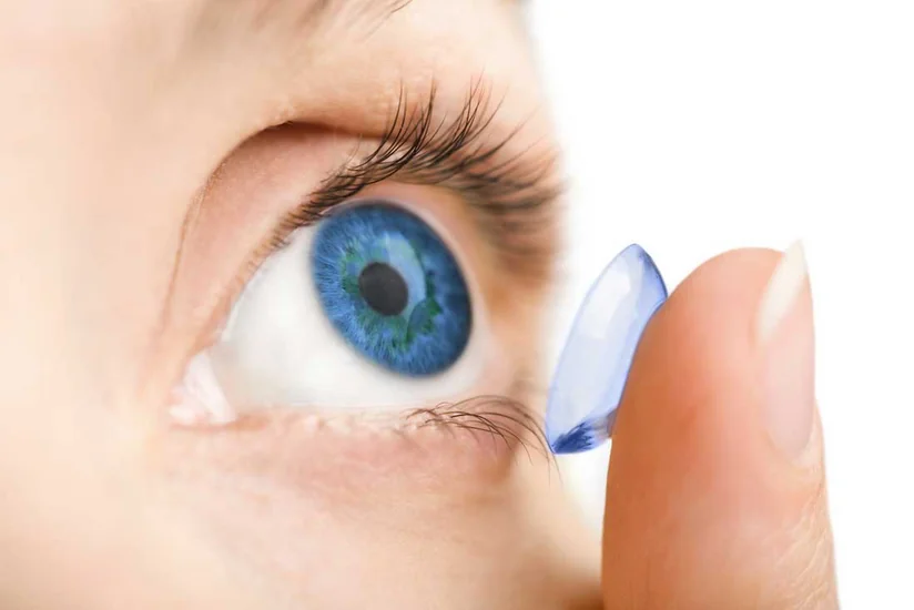 Azerbaijan sharply increases purchase of contact lenses from US and Turkiye