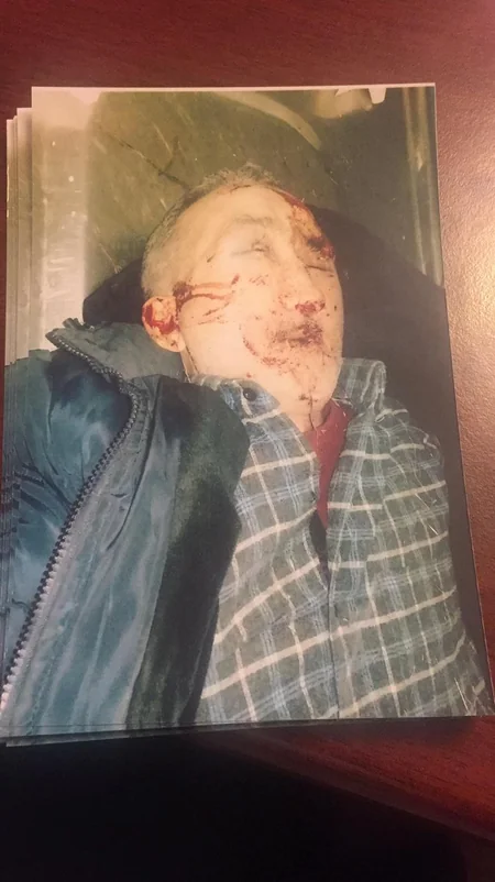 Goranboyda avtomobilin vuraraq öldürdüyü piyadanın yaxınları axtarılır - FOTO - YENİLƏNİB