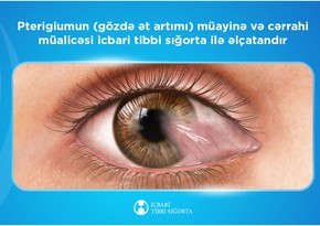 Ötən il icbari tibbi sığorta ilə gözdə ət artığının götürülməsi üçün 2192 əməliyyat edilib