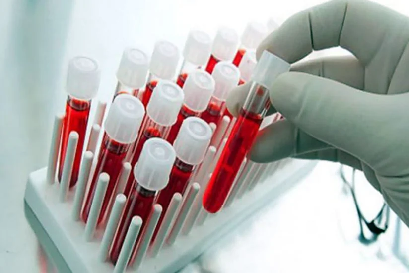 Komitə sədri: Hər il yüzlərlə nikaha girmək istəyənlər arasında təhlükəli xəstəliklər aşkarlanır